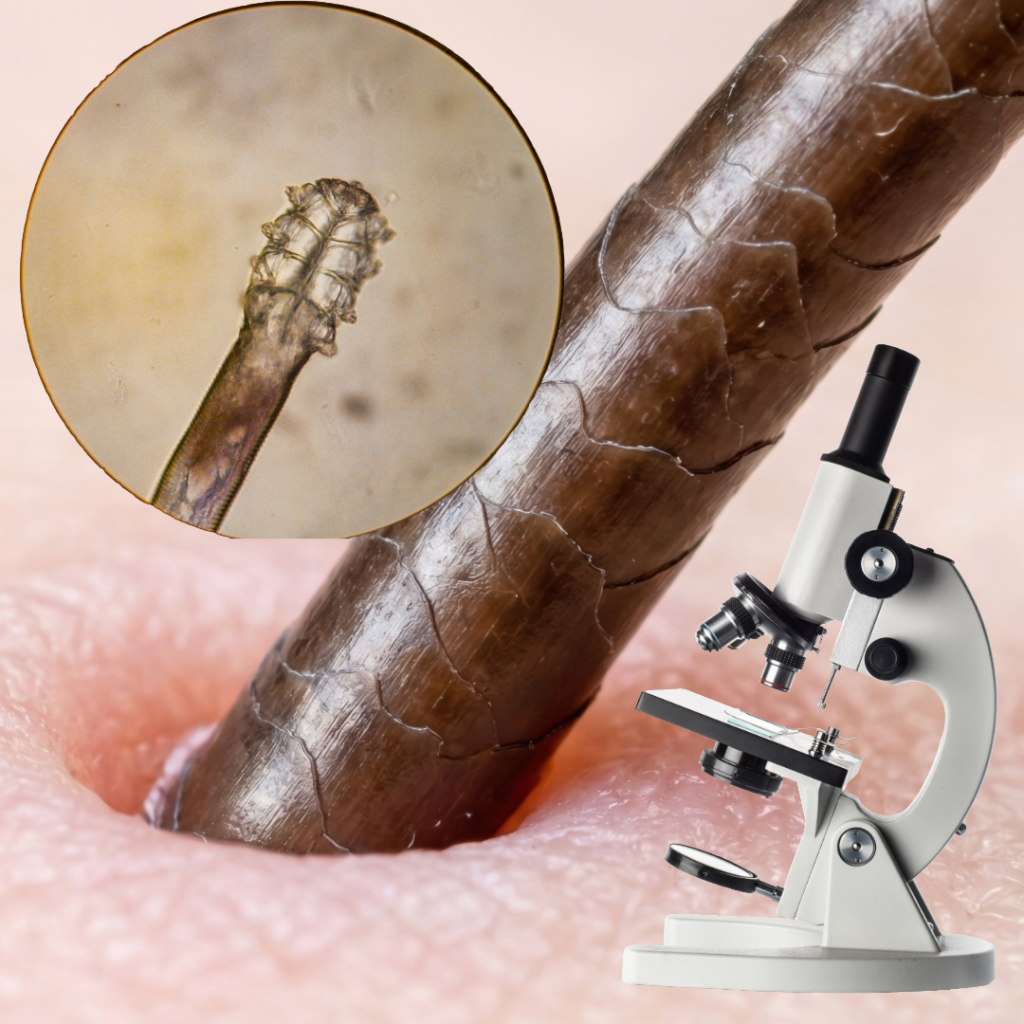 Composite educational image showing a Demodex mite on a microscope slide alongside a macro photograph of a hair follicle, illustrating why the no-poo method fails to address what lives inside scalp follicles